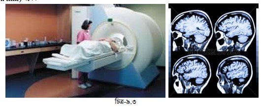 রোগ নির্ণয়ে MRI পরীক্ষার মূলনীতি